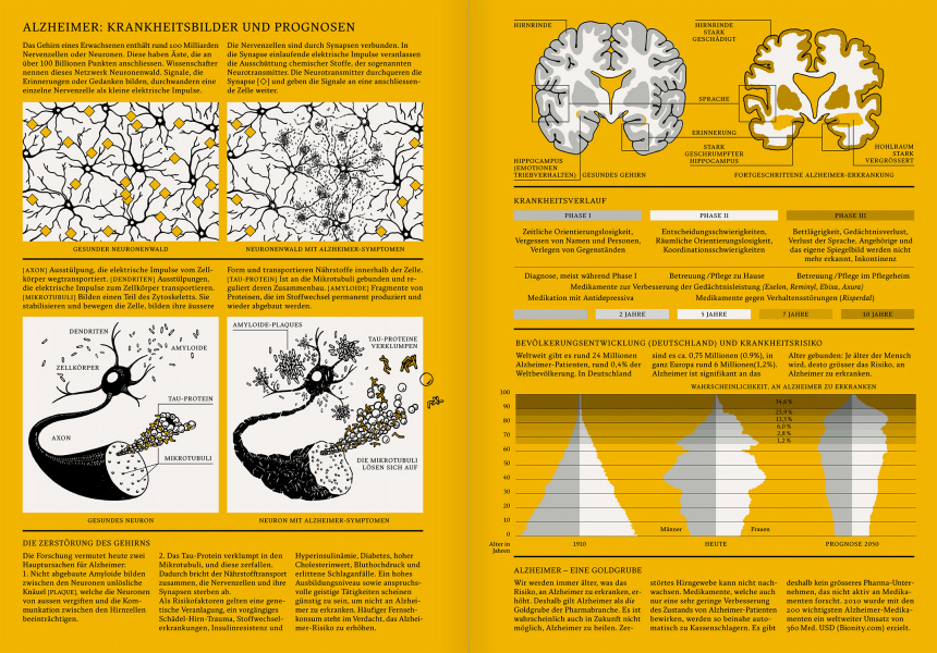 Reportagen #09 Infographic Alzheimer